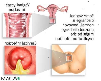 Hvordan man skal håndtere menstrual lukt. Bruk sunnere menstrual produkter.